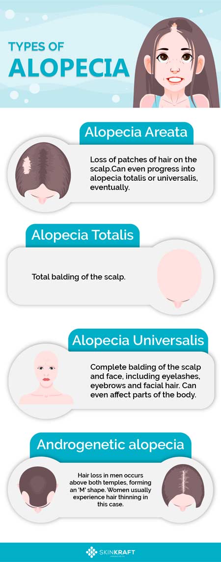 Soorten alopecia 
