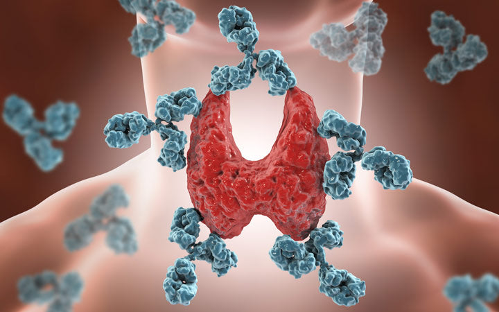 auto-immune thyroiditis hashimotos ziekte 3d illustratie