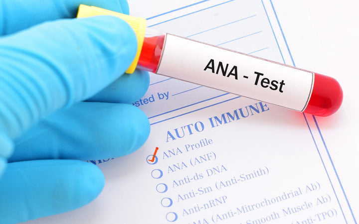 bloedmonster voor antinucleaire antilichaam (ANA) test auto-immuundiagnose