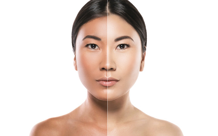 Huidbleken versus huidverlichting