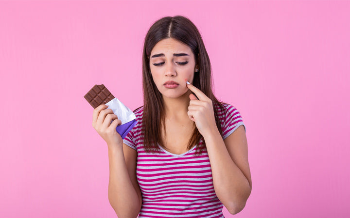 Kan chocolade eigenlijk acne puistjes veroorzaken?