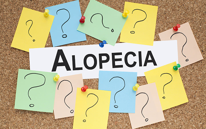 Alopecia Totalis: Symptomen, Oorzaken, Behandelingen &Risicofactoren