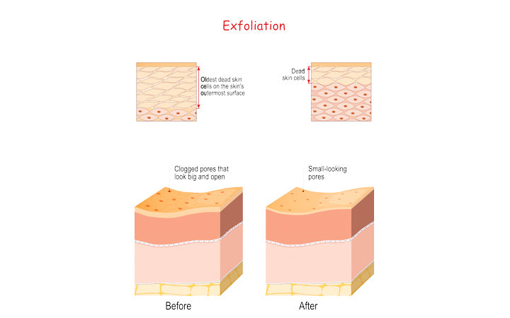 doorsnede van huidlagen voor en na exfoliatie