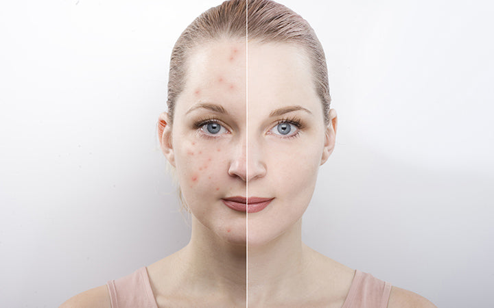 meisjesgezicht voor en na verschil cosmetische ingrepen
