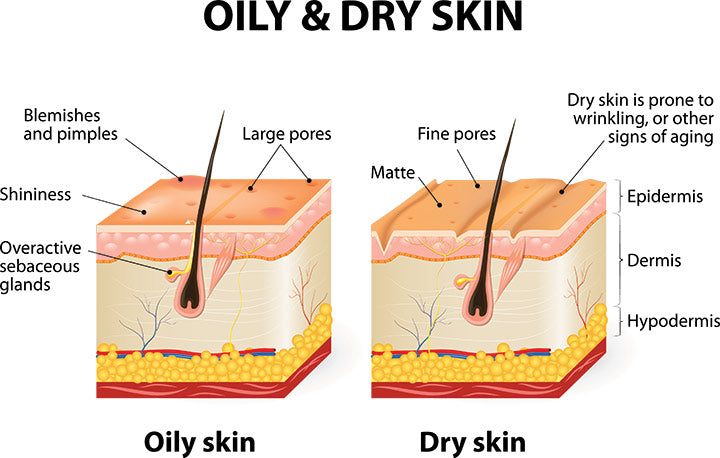 verschillende menselijke huidtypes vette en droge huid