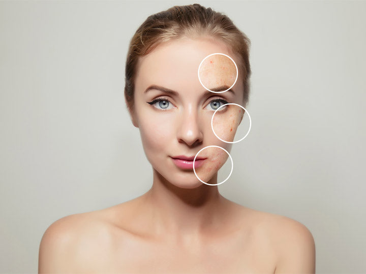 5 verschillende soorten huidvlekken op het gezicht en de behandelingen