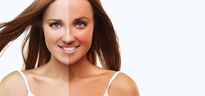 Hoe tan van je gezicht en huid te verwijderen?