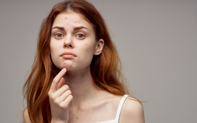 16 effectieve huidverzorgingstips voor tieners