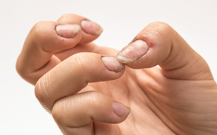 vrouwenhanden met vuile nagels