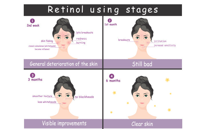 Vector poster stadia van het gebruik van actuele retinol acne behandeling