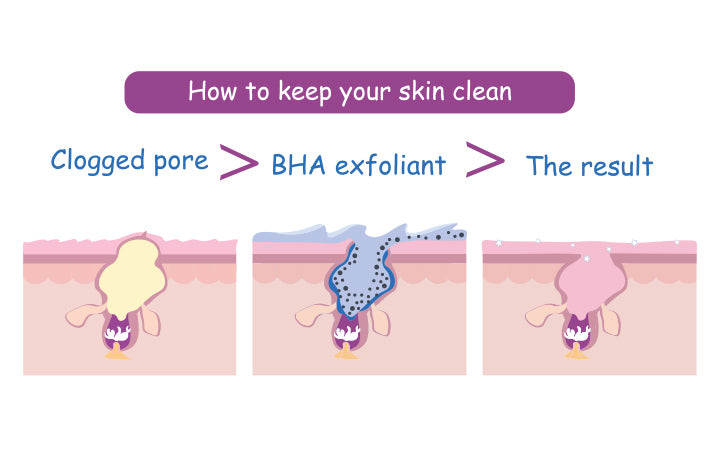 3 stappen voor het opruimen van verstopte poriën met behulp van bha salicylic cleanser exfoliant voor pure huidverzorging routine