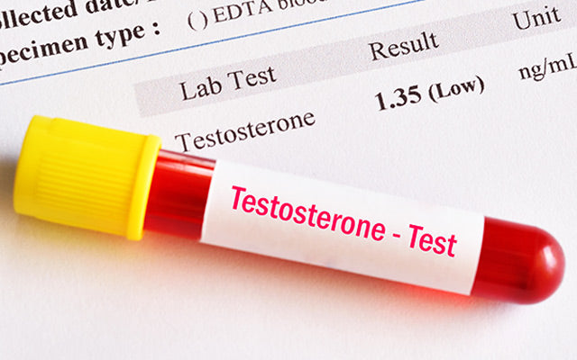 Abnormale lage testosteron hormoon test
