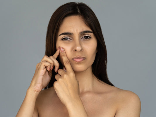 5 oorzaken van witte vlekken op het gezicht en hoe ze te beheren
