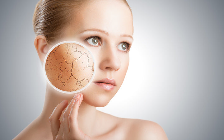 10 redenen waarom je een droge huid hebt, zelfs na het hydrateren